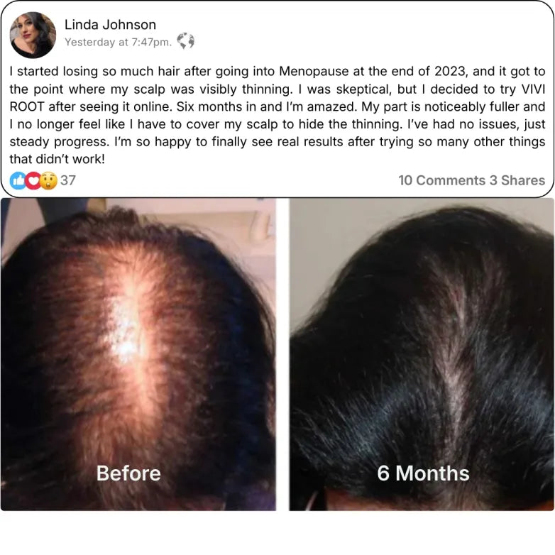 VIVI ROOT Micro-Infusion Stamper Thinning System