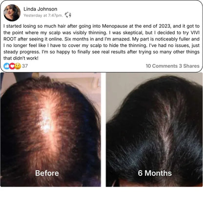 VIVI ROOT Micro-Infusion Stamper Thinning System